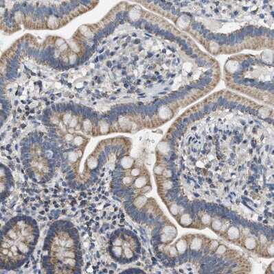Immunohistochemistry-Paraffin: GOT2 Antibody [NBP1-81565]