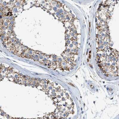 Immunohistochemistry-Paraffin: GOT2 Antibody [NBP1-81565]