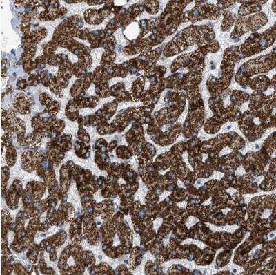 Immunohistochemistry-Paraffin: GOT2 Antibody [NBP1-81565]