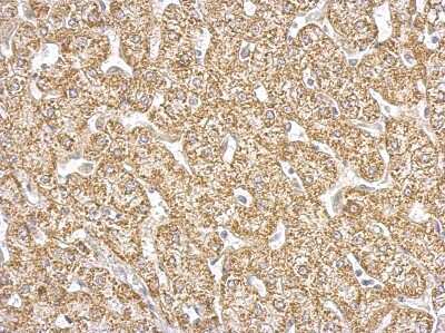 Immunohistochemistry-Paraffin: GOT2 Antibody [NBP2-16708]