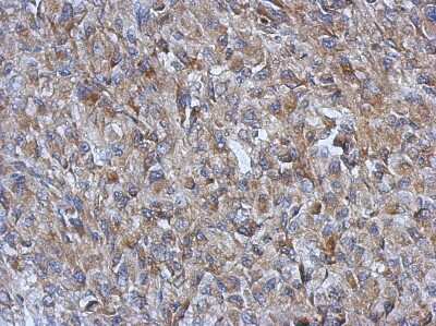 Immunohistochemistry-Paraffin: GOT2 Antibody [NBP2-16708]