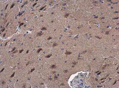 Immunohistochemistry-Paraffin: GOT2 Antibody [NBP2-16708]