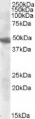 Western Blot: GOT2 Antibody [NBP1-00195]