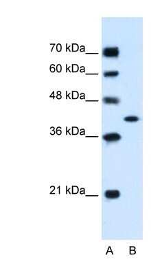 Western Blot: GOT2 Antibody [NBP1-80521]