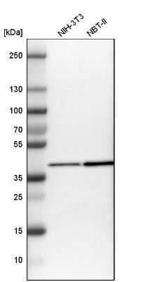 Western Blot: GOT2 Antibody [NBP1-81565]