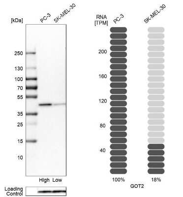 Western Blot: GOT2 Antibody [NBP1-81565]