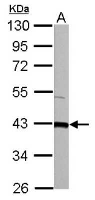 Western Blot: GOT2 Antibody [NBP2-16708]