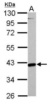 Western Blot: GOT2 Antibody [NBP2-16708]