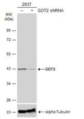 Knockout Validated: GOT2 Antibody [NBP2-16708]
