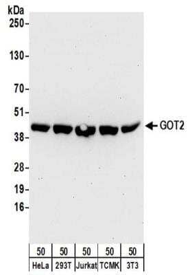 Western Blot: GOT2 Antibody [NBP2-32241]