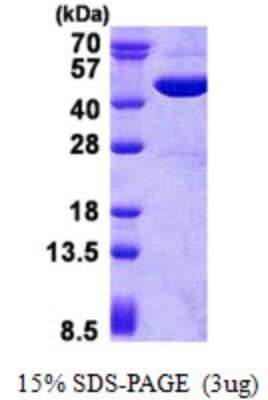 SDS-PAGE: Recombinant Human GOT2 His Protein [NBP2-23078]