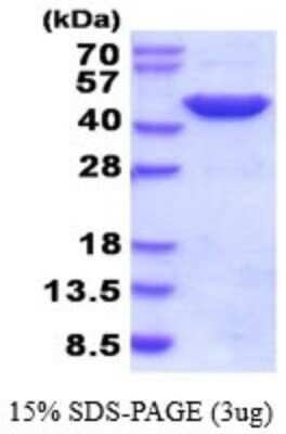 SDS-PAGE: Recombinant Human GOT2 His Protein [NBP2-52146]