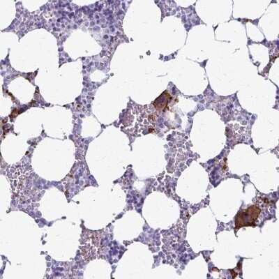 Immunohistochemistry-Paraffin: GP-IX Antibody [NBP2-38018]