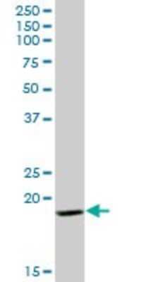 Western Blot: GP-IX Antibody [H00002815-B01P]