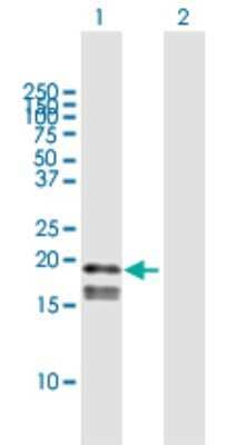 Western Blot: GP-IX Antibody [H00002815-B01P]