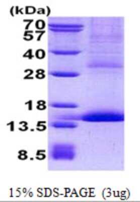 SDS-PAGE: Recombinant Human GP-IX His Protein [NBP2-23083]