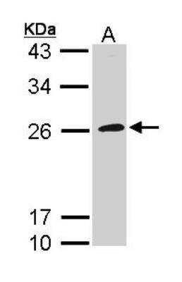 Western Blot: GP1BB Antibody [NBP1-33169]