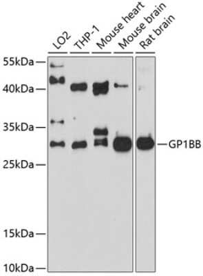 Western Blot: GP1BB AntibodyBSA Free [NBP3-04913]