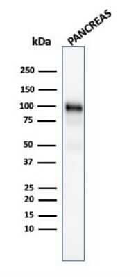 Western Blot: GP2 Antibody (GP2/1805) [NBP3-07327]