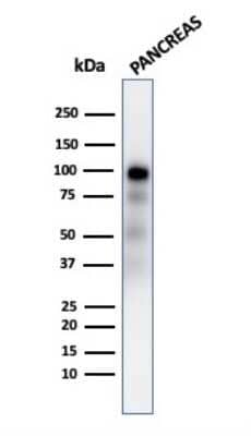 Western Blot: GP2 Antibody (GP2/2569R)Azide and BSA Free [NBP3-08242]