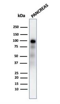 Western Blot: GP2 Antibody (GP2/2569R) [NBP3-07338]