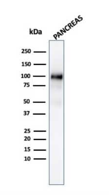 Western Blot: GP2 Antibody (GP2/3134R)Azide and BSA Free [NBP3-08243]