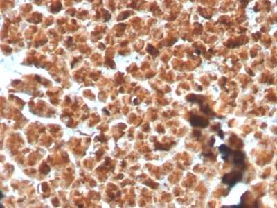 Immunohistochemistry-Paraffin: GP2 Antibody (GP2/3134R) [NBP3-07339]