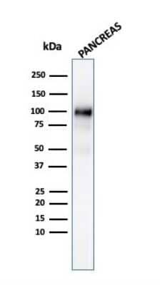 Western Blot: GP2 Antibody (GP2/3134R) [NBP3-07339]