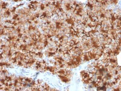 Immunohistochemistry-Paraffin: GP2 Antibody (GP2/3416) [NBP3-07328]