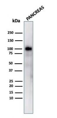 Western Blot: GP2 Antibody (GP2/3416) [NBP3-07328]