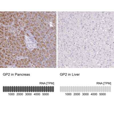 Immunohistochemistry-Paraffin: GP2 Antibody [NBP1-86061]