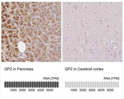 Immunohistochemistry-Paraffin: GP2 Antibody [NBP1-86070]