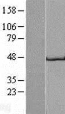 Western Blot: GP2 Overexpression Lysate [NBL1-11210]