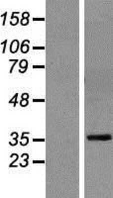 Western Blot: A33/GPA33 Overexpression Lysate [NBP2-07697]