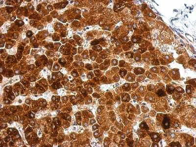 Immunohistochemistry-Paraffin: GPAA1 Antibody [NBP2-16709]