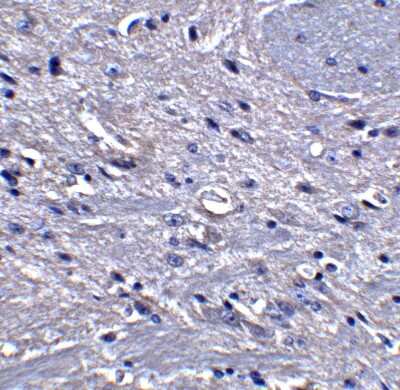 Immunohistochemistry-Paraffin: GPAM Antibody - BSA Free [NBP1-76907]