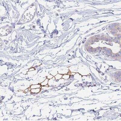 Immunohistochemistry-Paraffin: GPAM Antibody [NBP2-14065]