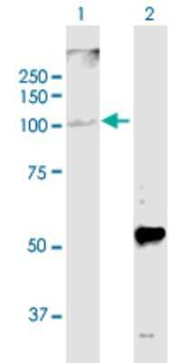 Western Blot: GPAM Antibody [H00057678-B01P]