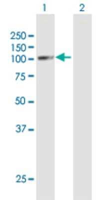 Western Blot: GPAM Antibody [H00057678-D01P]