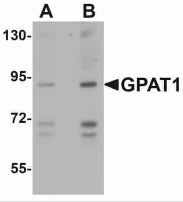 Western Blot: GPAM AntibodyBSA Free [NBP1-76907]