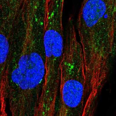 Immunocytochemistry/ Immunofluorescence: GPAT2 Antibody [NBP1-84360]