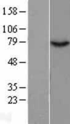 Western Blot: GPAT2 Overexpression Lysate [NBL1-12580]