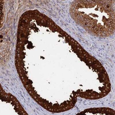 Immunohistochemistry-Paraffin: GPATCH1 Antibody [NBP1-91957]