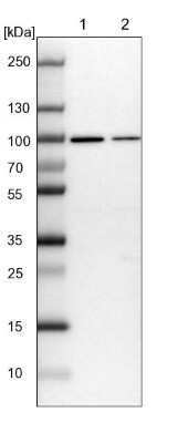 Western Blot: GPATCH1 Antibody [NBP1-91958]