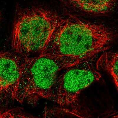 Immunocytochemistry/ Immunofluorescence: GPATCH2L Antibody [NBP1-94046]