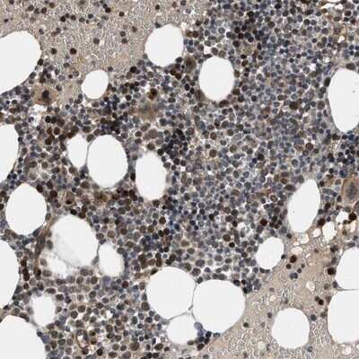 Immunohistochemistry-Paraffin: GPATCH2L Antibody [NBP1-94046]