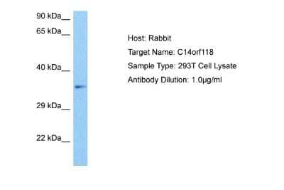 Western Blot: GPATCH2L Antibody [NBP2-82905]