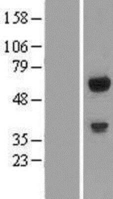 Western Blot: GPATCH2L Overexpression Lysate [NBP2-06898]