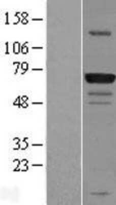 Western Blot: GPATCH3 Overexpression Lysate [NBL1-11215]