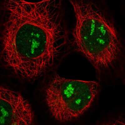 Immunocytochemistry/ Immunofluorescence: GPATCH4 Antibody [NBP1-85131]